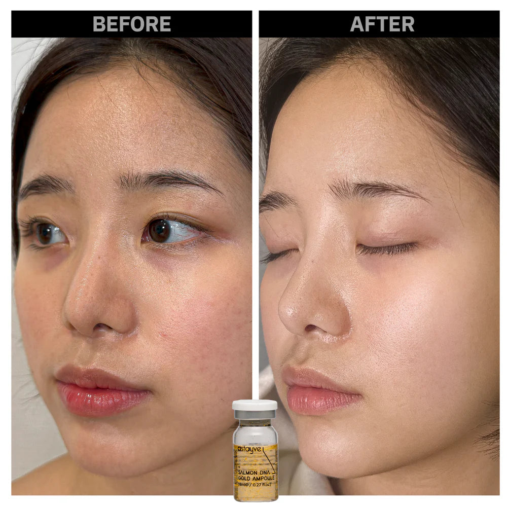 Stayve Booster Starter Kit (Microneedling Ampoule)